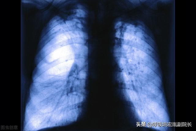 肺病到底有多少种（最常见的有这五种）(4)