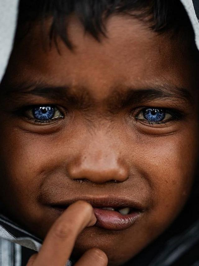 世界上唯一红眼睛的人（他们是亚洲人却被称为精灵）(6)