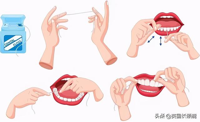 去牙石牙膏漱口水 牙齿健康敲重要(18)