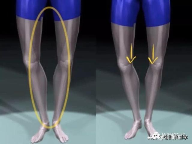 x型腿矫正的瑜伽方法（练瑜伽什么是）(14)