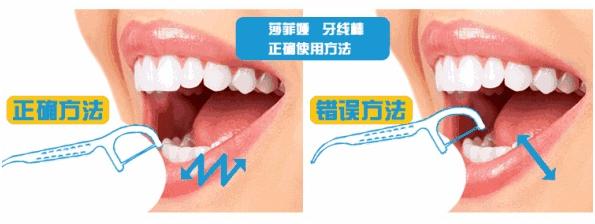 没有缝隙的牙线怎么使用（你会使用牙线吗）(2)