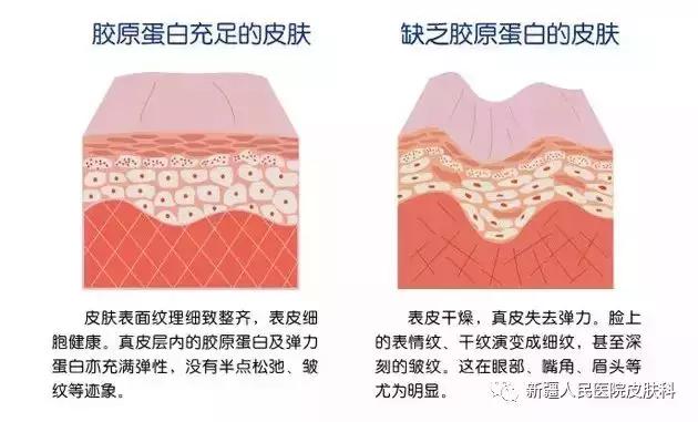 使用激光容易造成皮肤变薄的原因（激光会让皮肤变薄吗）(2)
