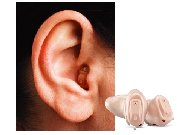 怎么给老人选助听器呢（如何给老人选择助听器）(5)