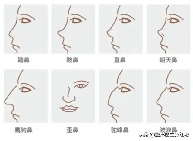 明星鼻子整形对比（最全鼻子整形案例）(2)