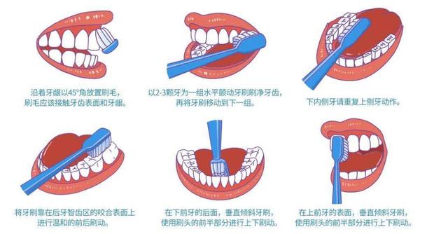 洗完牙第一天要注意什么（洗完牙不注意这几点）(3)