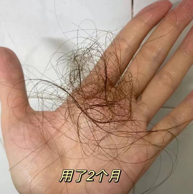 掉头发严重哪个牌子的洗发水好（掉头发掉的难受）(13)