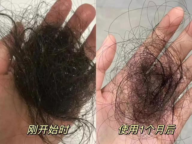 掉头发严重哪个牌子的洗发水好（掉头发掉的难受）(12)