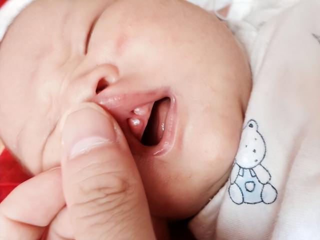 婴儿口腔卫生保健知识（婴儿口腔护理常见误区汇总）(5)