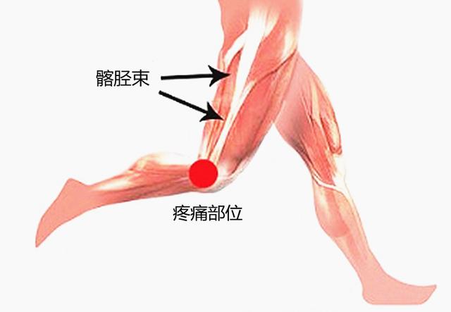 膝盖碰了针扎似的疼怎么回事（膝盖莫名其妙的疼痛）(4)
