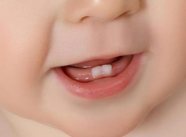 婴儿口腔卫生保健知识（婴儿口腔护理常见误区汇总）(4)