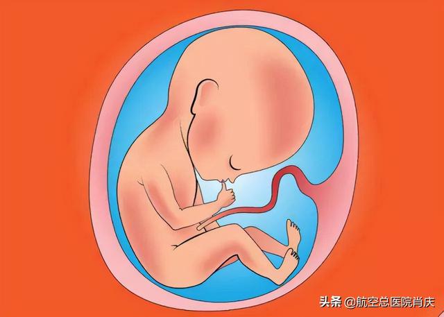 孕检胎儿脑积水是什么原因导致的（孕期检查出胎儿有脑积水）