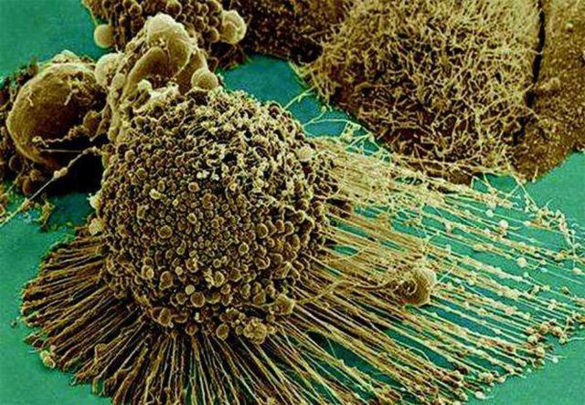 人身体细胞分裂（已故黑人妇女癌细胞无限分裂）(9)