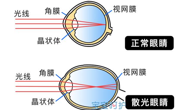 小孩体检发现眼睛有近视趋势（孩子眼睛有这3种症状）(8)