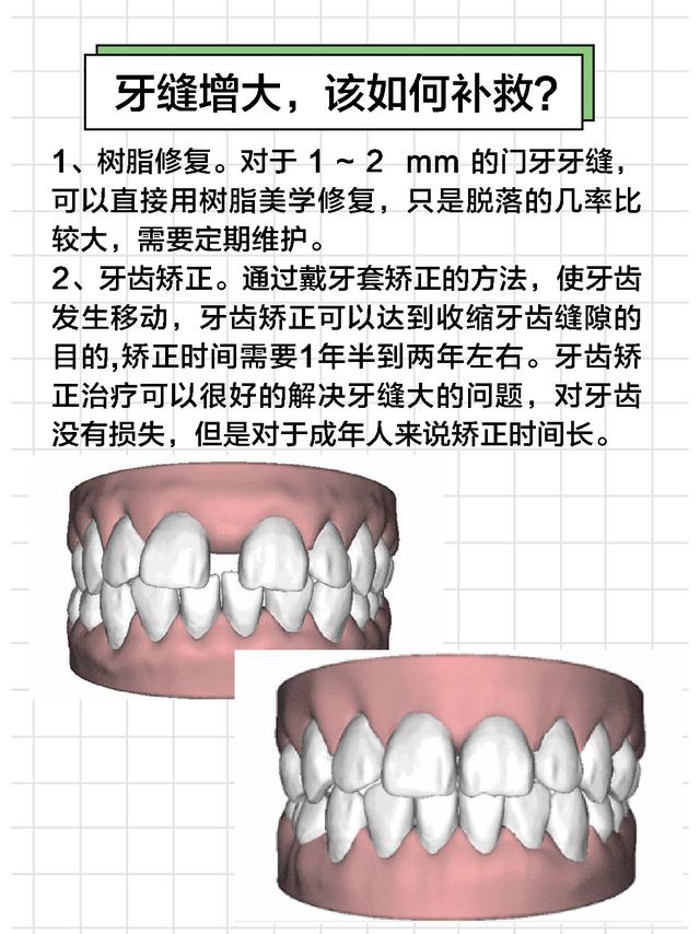 牙齿为什么会牙缝大（为何会出现牙缝增大）(5)