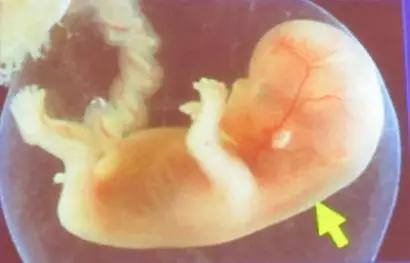孕中期胎儿系统超声什么时候检查（11-136周超声检查孕早期筛查的第一道关卡）(3)