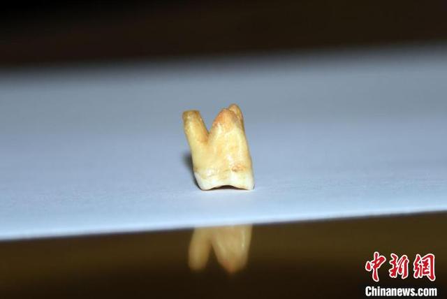 古人类有多少颗牙齿（这群古人类8-12万年前就会了）(1)